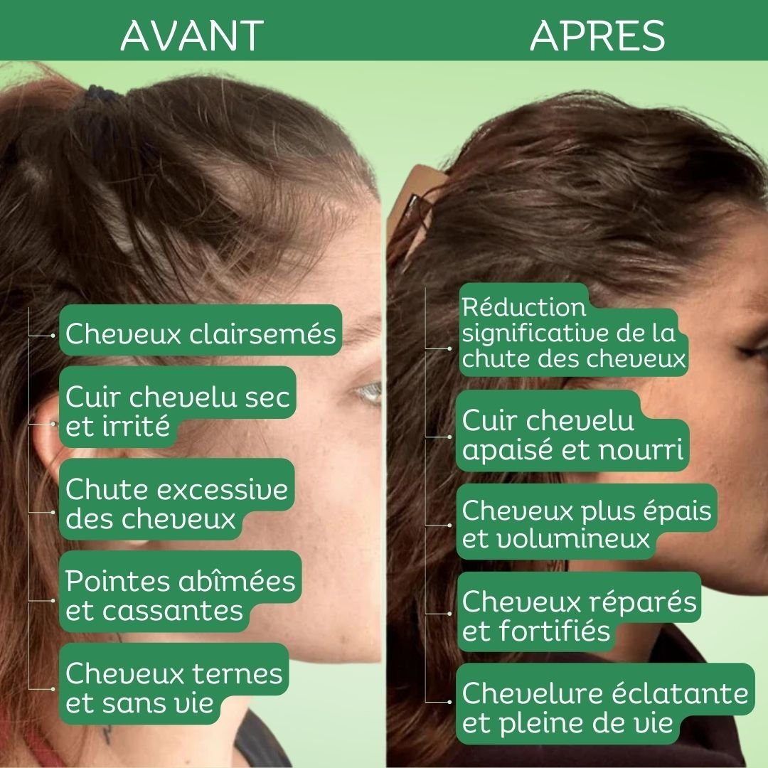 Texte alternatif de l'image