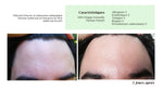 DROP - MERVEILLE DES LANDES ORGANIC - Sensitive Skin Care Complete Regeneration
