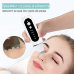 STELLAR - 5-Function EMS Lifting Exfoliator - Ultrasound & Photon Treatment