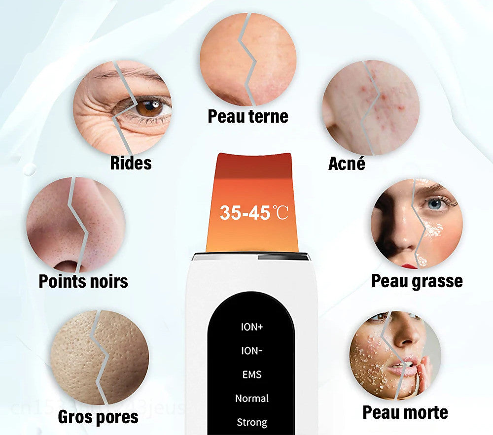 STELLAR - 5-Function EMS Lifting Exfoliator - Ultrasound & Photon Treatment